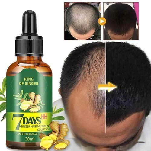 Ginger 7 Days Germinal Hair Growth Oil Essence