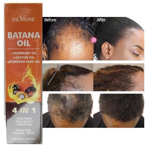 Sauvasine Batana Oil 4 In 1 Intense Hair Growth, Repair & Shine Formula With Rosemary, Castor & Pumpkin Seed Oils – 120ml