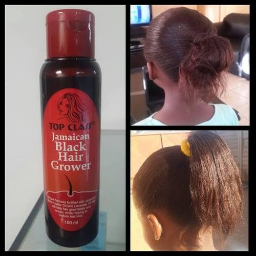Top Class Jamaican Hair Grower – Intensive Hair Care Treatment, 150ml
