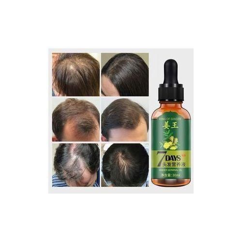 Aichun Beauty Hair Growth Serum For Men&Women- 7days Tonic Ginger Germinal Oil