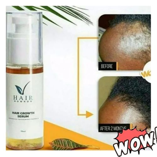 Hair Now Now Hairline Growth Serum.