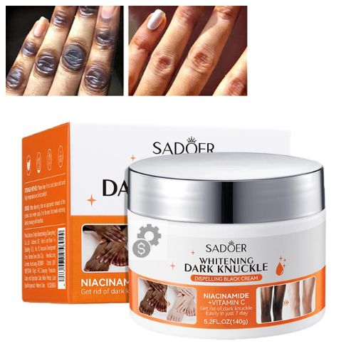 SADOER Spot Eraser Cream for Knuckles, Knees, and Elbows – Brightens and Smoothens Skin