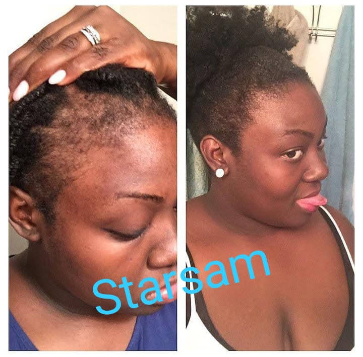 First Class Hair Booster