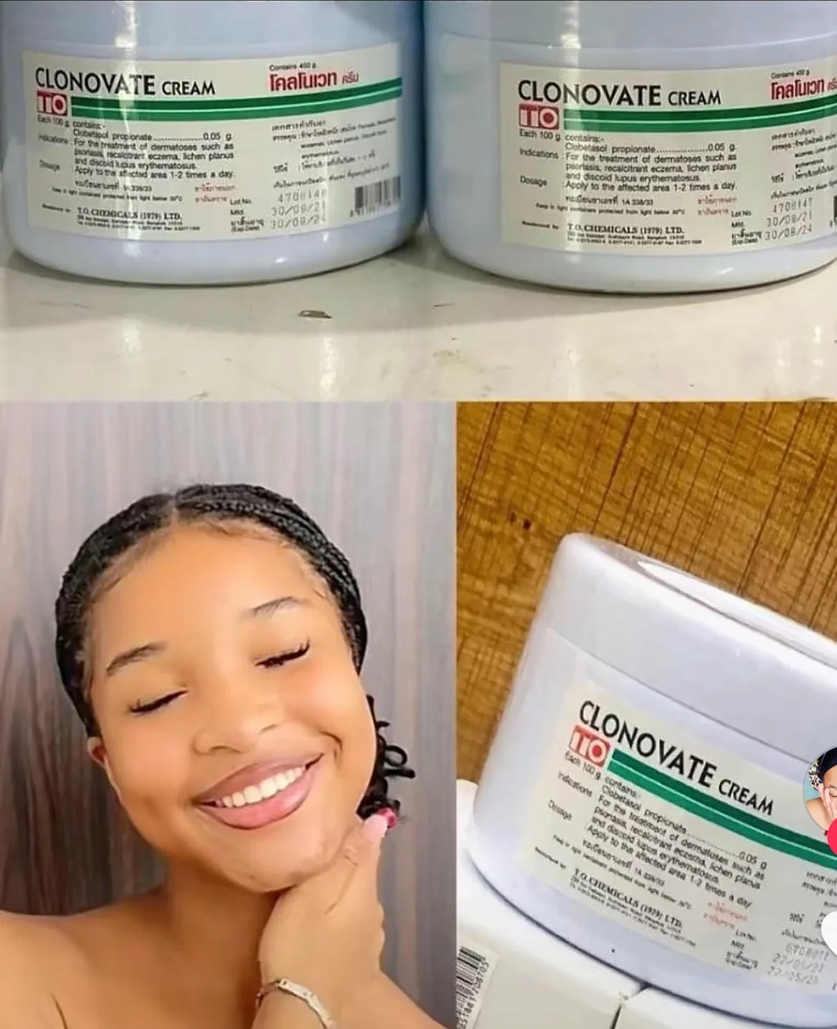 🔥 LIMITED DEAL — Clonovate 450g Body Whitening & Lightening Cream | Hyperpigmentation + Eczema + Dark Hands & Feet | KSh 4500 (
