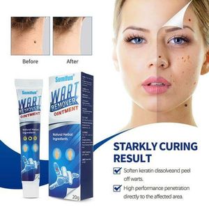 Original Sumifun Wart Remover Ointment 20g — Remove Warts, Skin Tags & Moles Fast | No Surgery Needed!