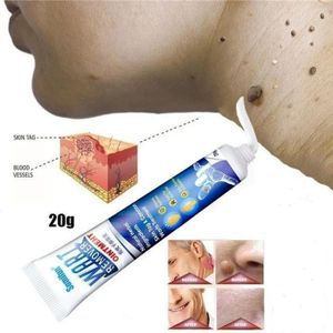 Original Sumifun Wart Remover Ointment 20g — Remove Warts, Skin Tags & Moles Fast | No Surgery Needed!