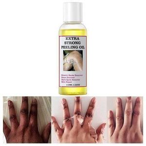 🔥 LIMITED DEAL — O'Carly Extra Strong Peeling Oil | Deep Exfoliation + Fades Dark Spots + Reveals Glowing Skin | KSh 1,800