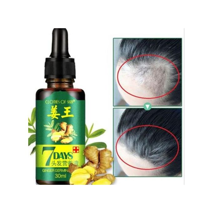 🔥 SALE — 7Days Ginger Hair Growth Oil 30ml | Stop Hair Loss + Regrow in 7 Days | Men & Women | KSh 1,400