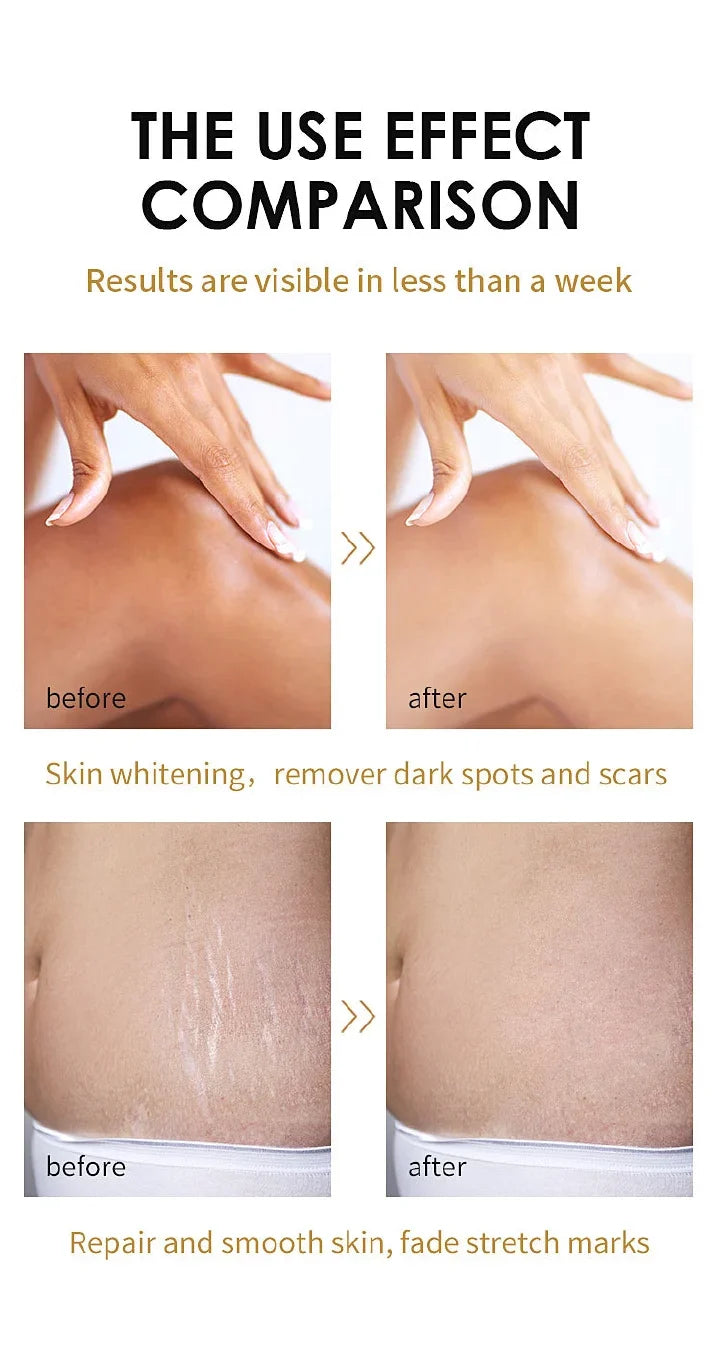 🔥 LIMITED DEAL — DR. MEINAIER Brightening Peeling Oil | Lightens Dark Elbows & Knees + Evens Skin Tone + Exfoliates & Renews | KSh 2,400