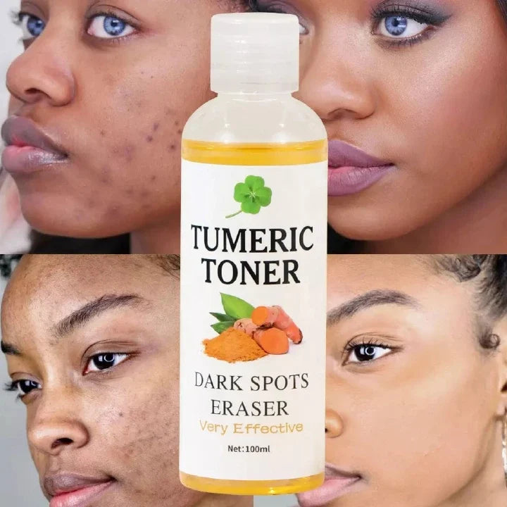 🔥 LIMITED DEAL — MOOYAM Quick Dark Spots Corrector Serum | Fades Dark Spots + Removes Acne Scars + Turmeric Brightening | KSh 1,450