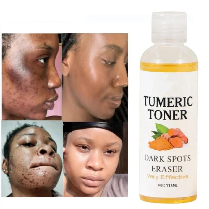 🔥 LIMITED DEAL — MOOYAM Quick Dark Spots Corrector Serum | Fades Dark Spots + Removes Acne Scars + Turmeric Brightening | KSh 1,450