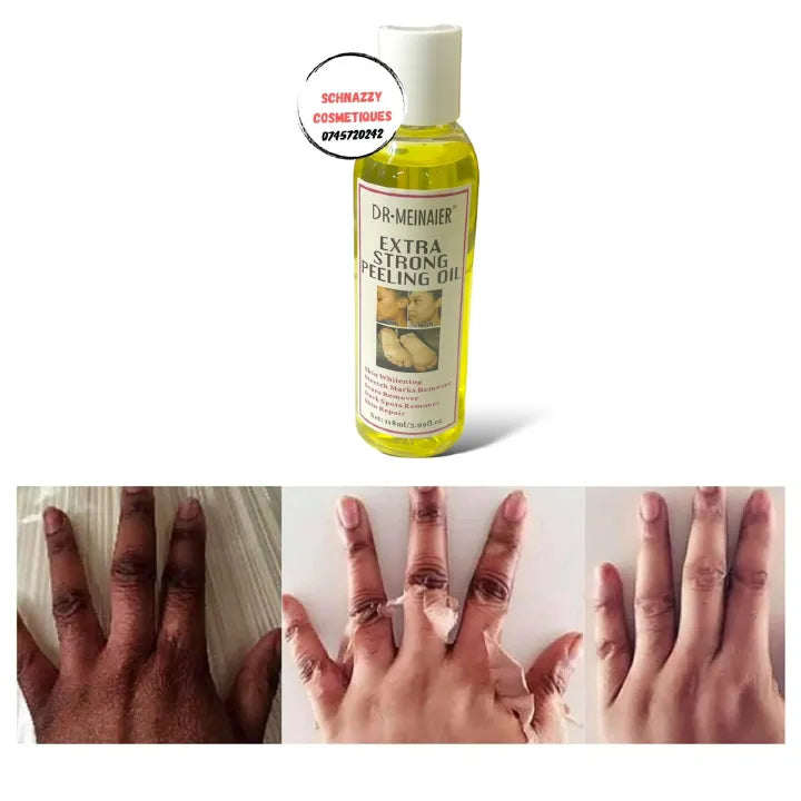 🔥 LIMITED DEAL — DR. MEINAIER Brightening Peeling Oil | Lightens Dark Elbows & Knees + Evens Skin Tone + Exfoliates & Renews | KSh 2,400