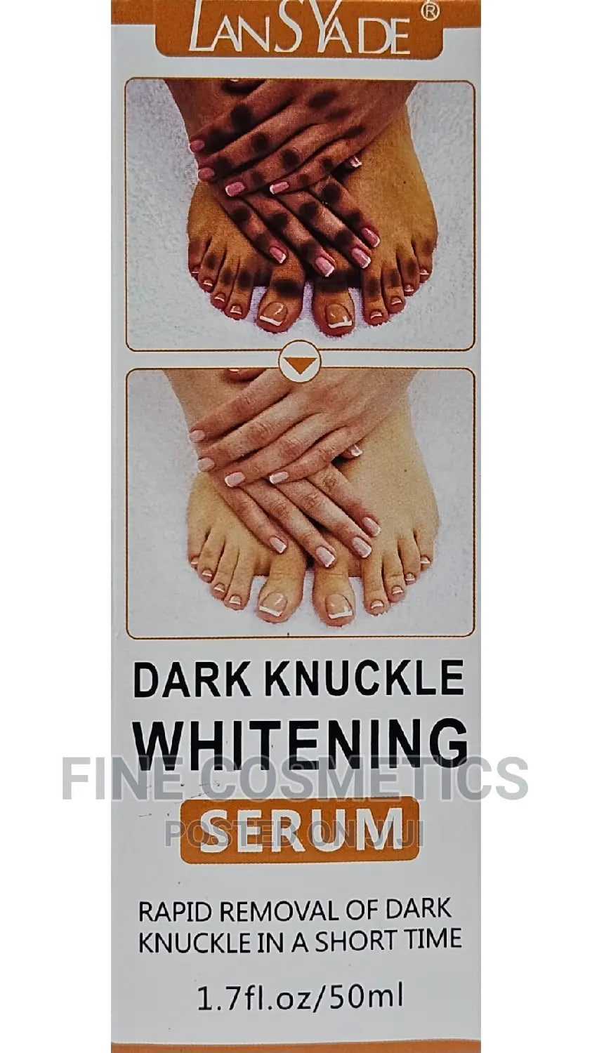 🔥 LIMITED DEAL — LansYade Dark Knuckle Whitening Serum 50ml | Fades Dark Knuckles + Brightens Elbows & Knees + Evens Skin Tone | KSh 1,500