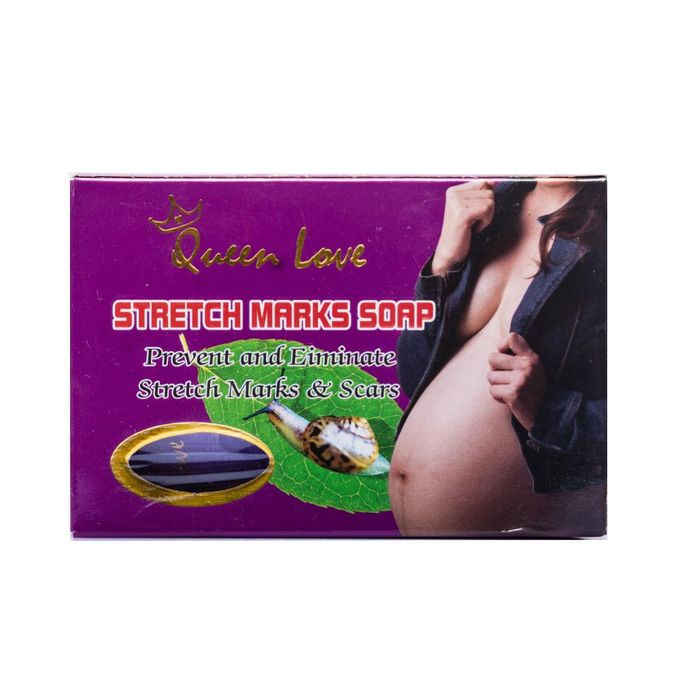 🔥 LIMITED DEAL — Queen Love Stretch Marks Soap 135g | Fades Stretch Marks & Scars + Brightens Skin + Safe for Pregnancy | KSh 1,200