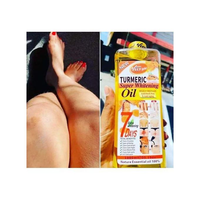 🔥 LIMITED DEAL — VEET GOLD Super Whitening Turmeric Oil | Brightens Skin + Fades Dark Spots & Stretch Marks + Firms with Collagen | KSh 2,200