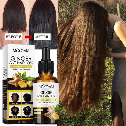 Fast Hair Growth Essence Ginger Hair Scalp Nourishing Serum 30ml Hair Growth Essential Oil Anti-Hair Loss