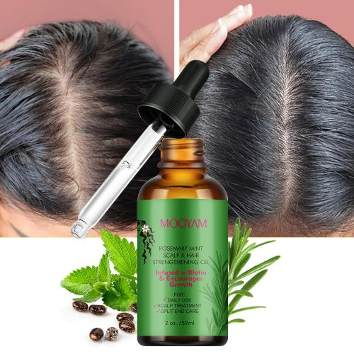 Rosemary Mint Oil Scalp And Hair Strengthening Scalp Treatment With Biotin Hair Growth Rosemary Mint Oil Nourishing Treatment