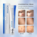 🔥 LIMITED DEAL — MOOYAM Skin Repair & Scar Removal Cream | Fades Scars + Clears Acne Marks + Removes Stretch Marks | KSh 4,320