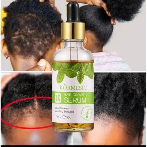 KORMESIC Hair Growth Serum - 50g