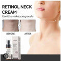 🔥 ORDER 1, WE SEND 2 — IREV Retinol Neck Cream 50ml | Tightens Neck + Smooths Wrinkles + Retinol & Niacinamide | KSh 2,400