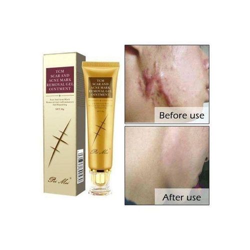 🔥 LIMITED DEAL — PeiMei TCM Lavender Scar & Stretch Mark Removal Oil | Fades Scars + Removes Stretch Marks + Repairs Skin | KSh 1,800