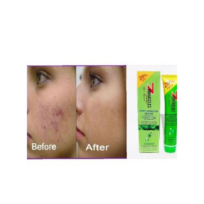 🔥 LIMITED DEAL — 7 Miracles Spot Remover Cream | Clears Dark Spots + Evens Skin Tone + Brightens & Smooths | KSh 1,200