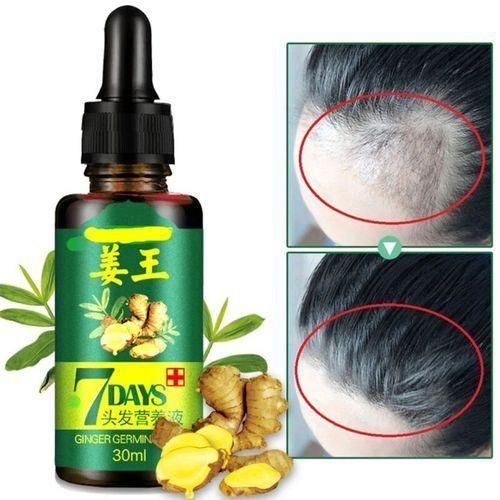 O'Carly 7Days Hair Tonic Ginger Germinal Growth Oil-30ml