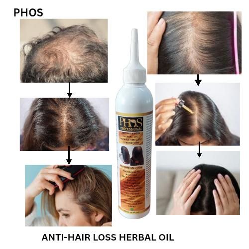 PHOS ANTI-HAIRLOSS HERBAL OIL