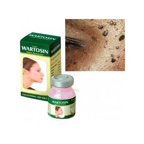 🔥 LIMITED DEAL — WARTOSIN Ayurvedic Warts Remover Ointment | Removes Warts in 4-5 Days + Safe for Face & Neck + No Scarring | KSh 2,398