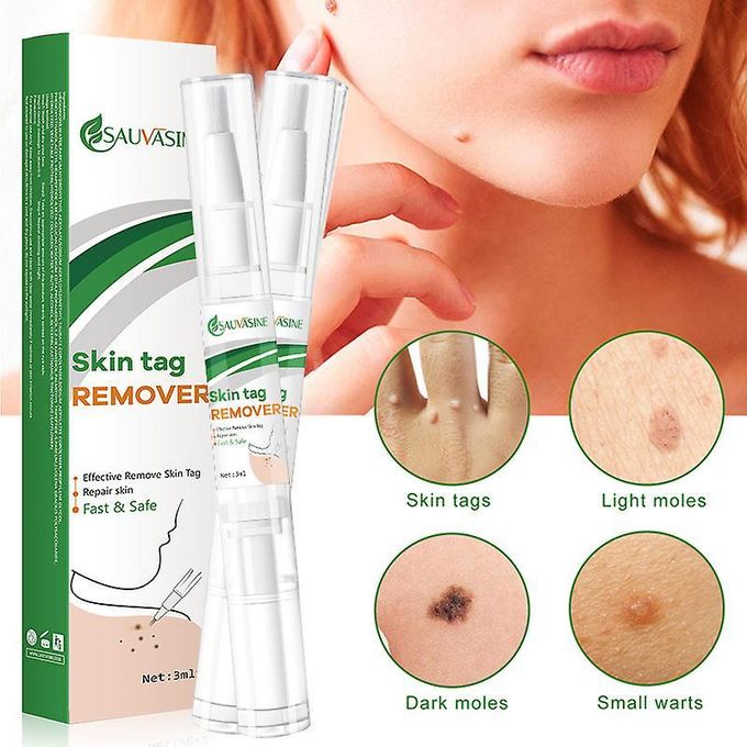 🔥 LIMITED DEAL — Sauvasine Skin Tag & Wart Remover Lotion | Painless + No Scarring + Natural Formula | KSh 1,800