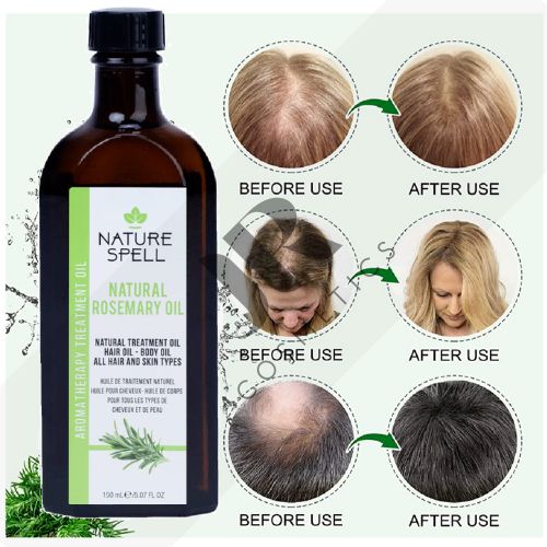 NATURE SPELL 100% Natural Rosemary Oil For Hair Growth & Skin, Pre-Diluted Treatment For Hair Loss-150mL (Free COMB)