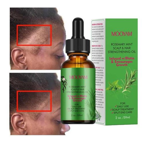 Rosemary Mint Hair Strengthening Oil Scalp Treatment With Biotin Hair Growth Rosemary Mint Oil Nourishing Treatment_59ML