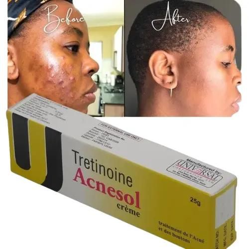 🔥 LIMITED DEAL — Acnesol Tretinoin Cream | Clears Acne + Fades Dark Marks + Smooths Skin | KSh 1,200