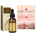 🔥 LIMITED DEAL — Pei Mei Collagen Scar & Acne Mark Removal Essence 30g | Fades Scars + Clears Acne Marks + Repairs Skin | KSh 1,500