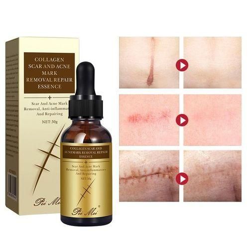 🔥 LIMITED DEAL — Pei Mei Collagen Scar & Acne Mark Removal Essence 30g | Fades Scars + Clears Acne Marks + Repairs Skin | KSh 1,500