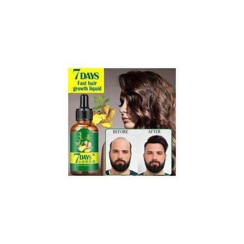 Aichun Beauty King Of Ginger 7 Days Hair Tonic,hair Growth Oil - 30ml