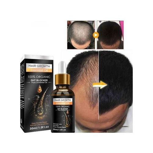 Hair Care Growth Essential Oil - 30ml