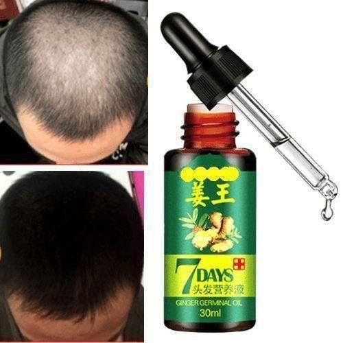 Hair Boost 7 Days Hair & Beard Growth Activator Hair Loss Oil