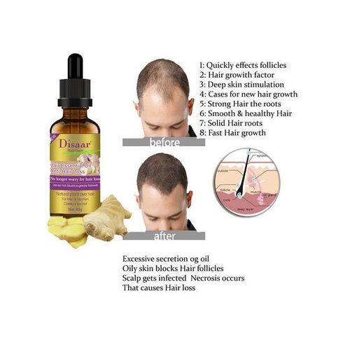 Disaar Hair Loss Essential Oil- Hair Growth In Baldness