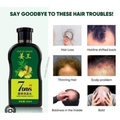 Natural Organic Hair Regrowth Ginger Oil, Healthy Strong Thick Hair Falling Anti Hair Loss Solution Baldness Treatment Hair Care Repair Hair Growth Serum Spray For Men And Women