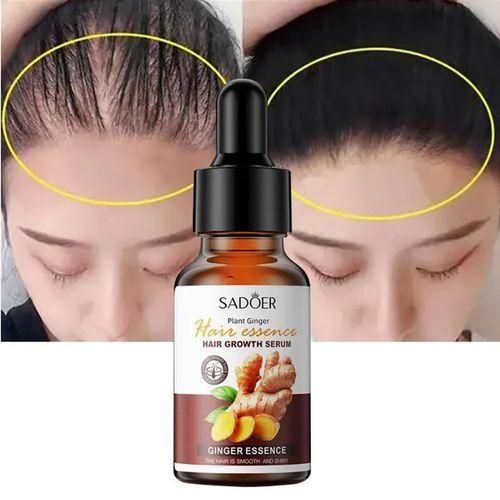 SADOER Hair Growth Serum Ginger Essence Hair Care Oil