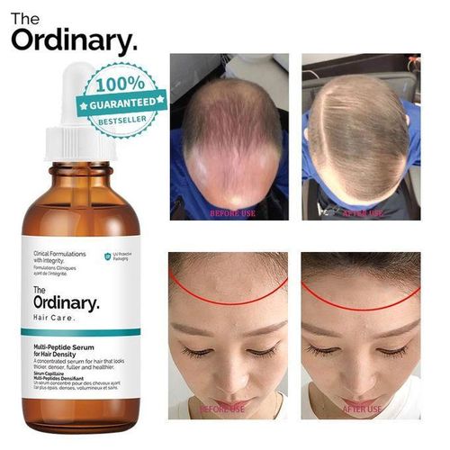 The Ordinary Hair Growth Serum/Multi-peptide Serum For Hair Density