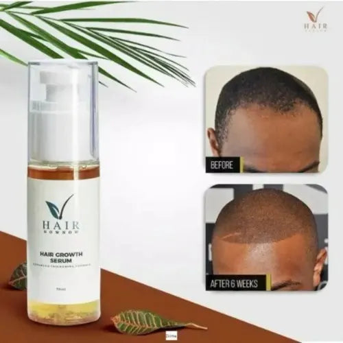 🔥 ORDER 1, WE SEND 2 — Hair Now Now Hair Growth Oil & Serum | Grows Hair Faster + Stops Shedding + Strengthens Roots | KSh 1,800