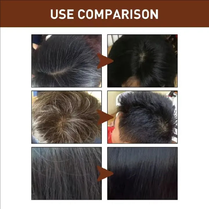 🔥 BUY 1 GET 1 FREE — JAYSUING Gray & White Hair Shampoo Bar | Banish Yellow Tones + Restore Silver Shine | KSh 1,800