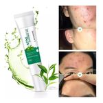 🔥 LIMITED DEAL — Lanthome Acne Control Gel 20g | Clears Pimples + Fades Blemishes + Smooths Skin | KSh 1,800