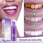 🔥 31% OFF — Lanthome Teeth Whitening Mousse 50ml | Whiter Teeth, Fresh Breath & No Dentist Needed!