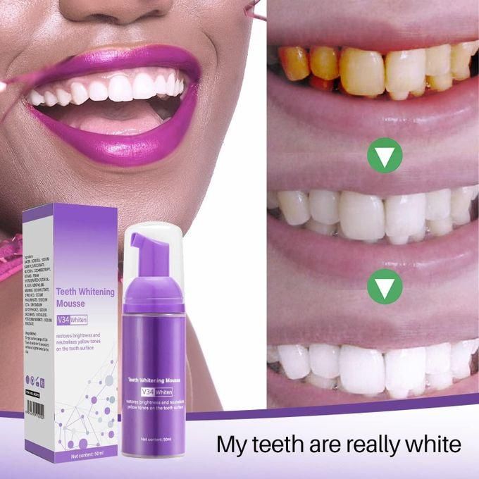 🔥 31% OFF — Lanthome Teeth Whitening Mousse 50ml | Whiter Teeth, Fresh Breath & No Dentist Needed!
