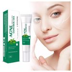 🔥 LIMITED DEAL — Lanthome Acne Control Gel 20g | Clears Pimples + Fades Blemishes + Smooths Skin | KSh 1,800