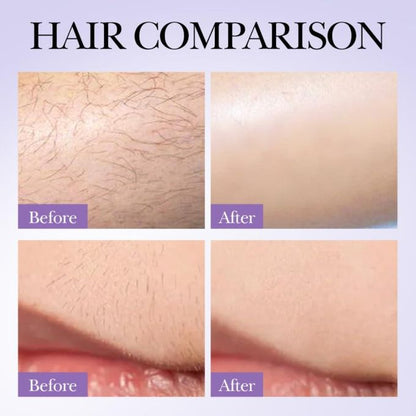 SADOER Hair Growth Inhibition Spray – 30ml