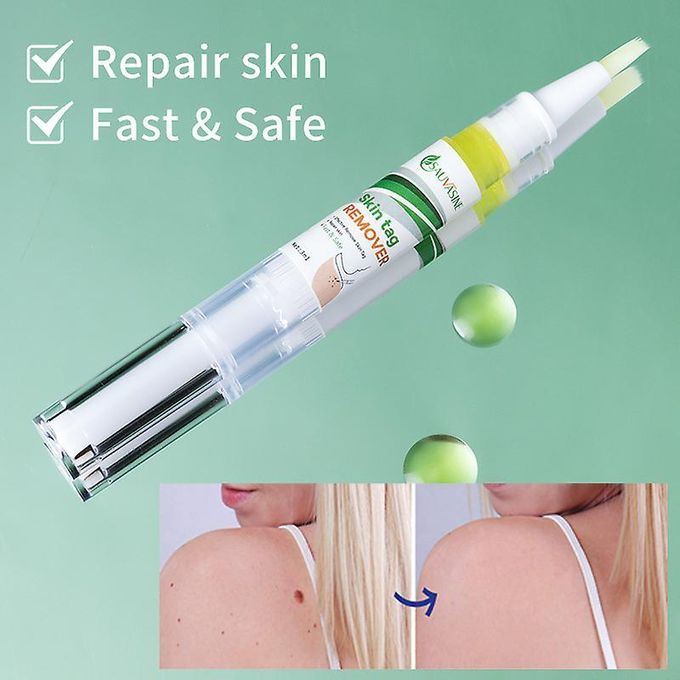 🔥 LIMITED DEAL — Sauvasine Skin Tag & Wart Remover Lotion | Painless + No Scarring + Natural Formula | KSh 1,800